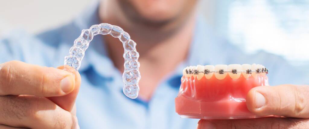 Clear Aligners vs. Traditional Braces: Which Orthodontic Treatment Is Right for You?